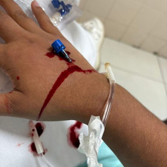 ALUMNA DE LA UV RELATA EXPLOSIÓN EN FACULTAD DE BIOANÁLISIS